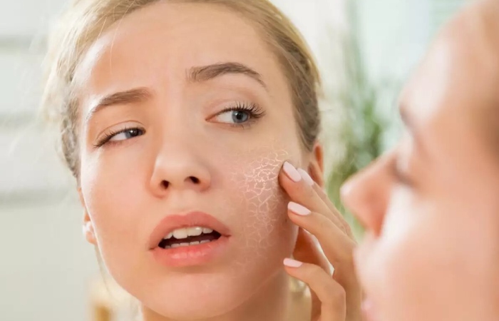 8 Common Causes of Dry Skin